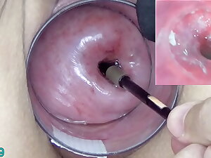Matured Milf Cervix Play with Endoscope Japanese Cam into Uterus